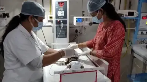 Baby Buried Alive in India Fights for Her Life